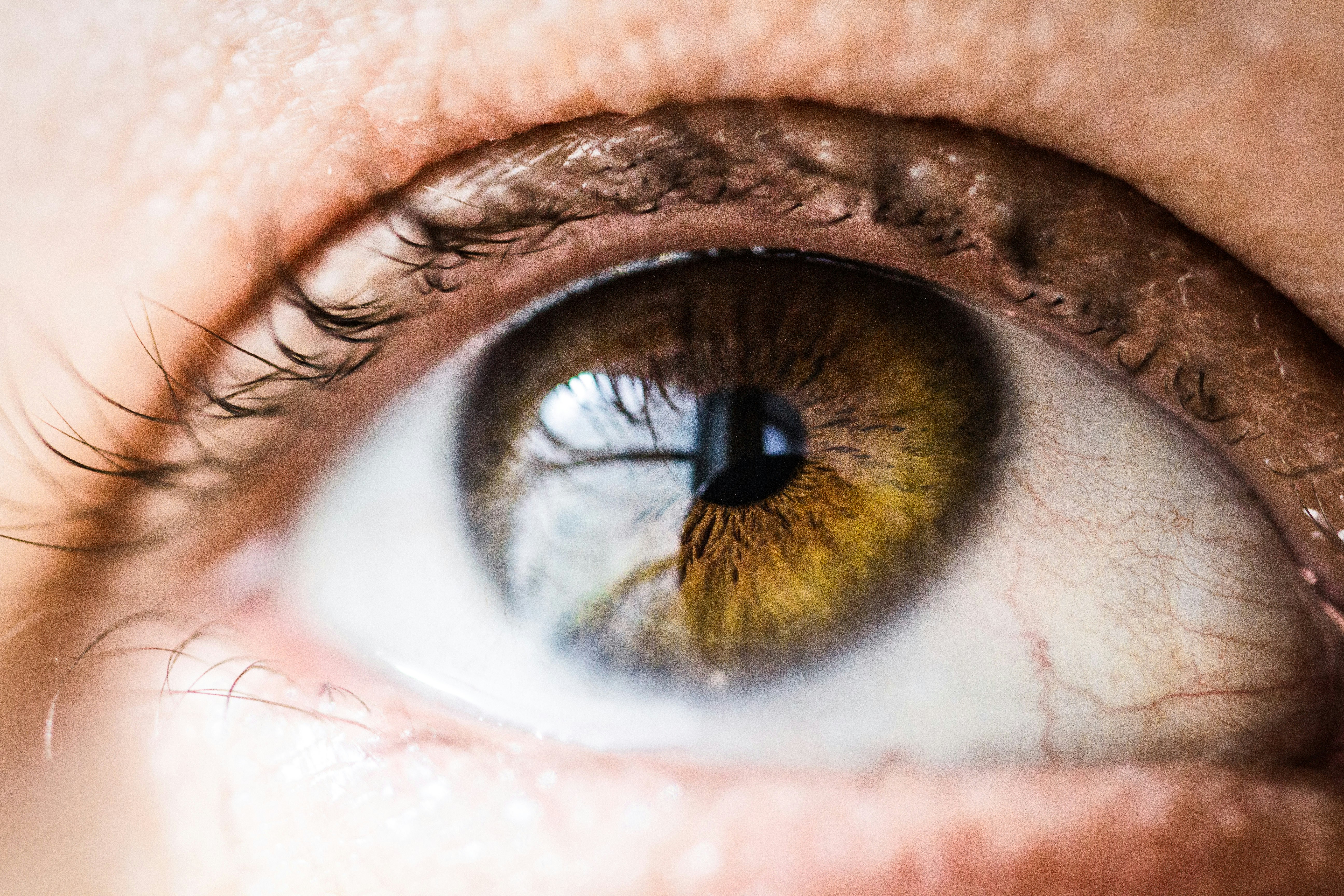 Pressure Behind Eyes