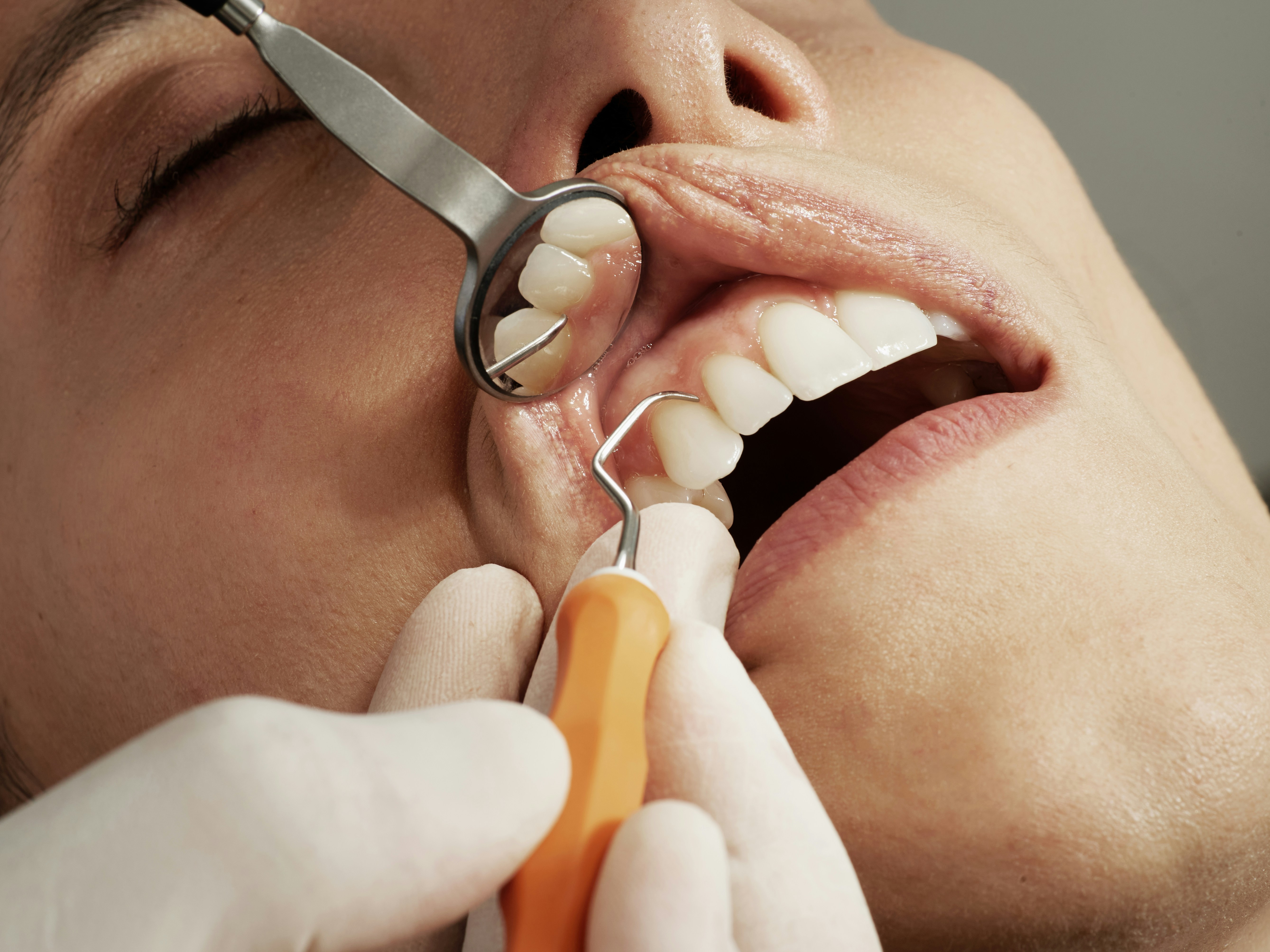 Teeth Chattering