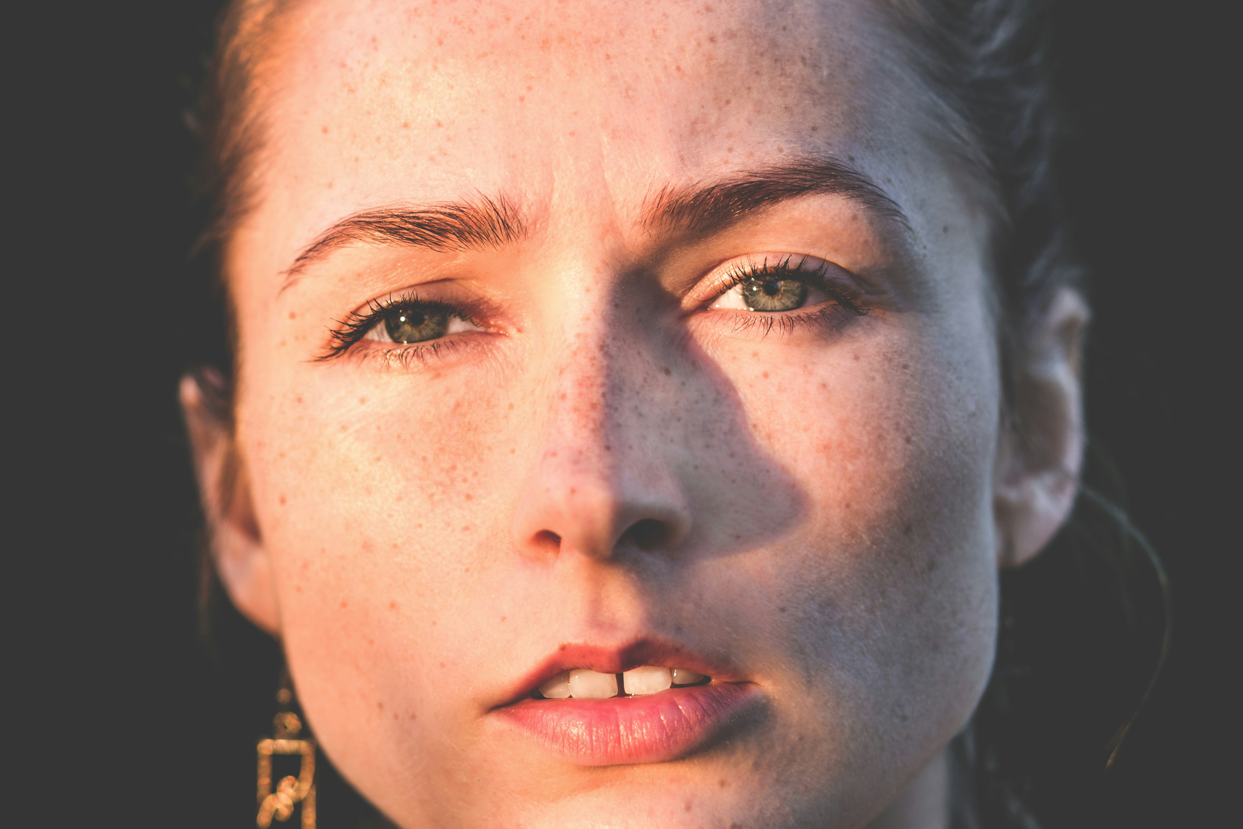 Microneedling